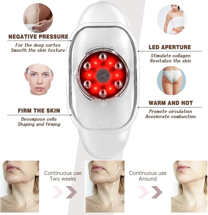 Thermoslim Body Sculpting Device - Triple-Action Sculpiflex Cellulite Device, Thermoslim Machine with Suction & Vibration for Thighs, Say Goodbye to Stubborn Cellulite