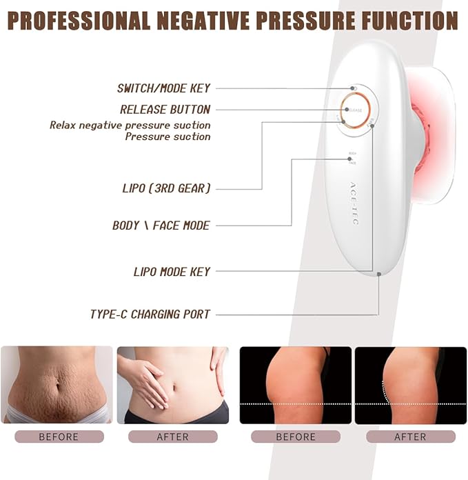 Thermoslim Body Sculpting Device - Triple-Action Sculpiflex Cellulite Device, Thermoslim Machine with Suction & Vibration for Thighs, Say Goodbye to Stubborn Cellulite