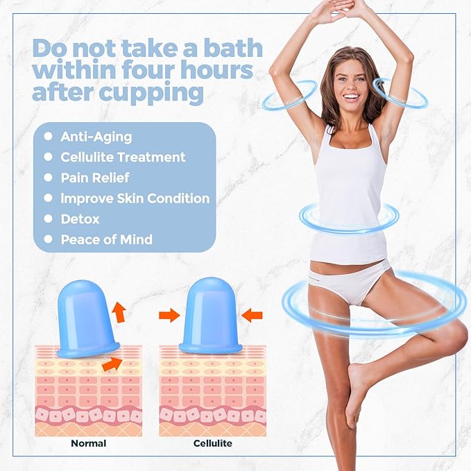 TrelaCo 12 Pcs 2 Size Cupping Therapy Set Silicone Anti Cellulite Cupping Kit for Massage Therapy Cupping Therapy Set Vacuum Suction Cup for Arthritis Relief, Pain Reduction Adults Home Use(Blue)